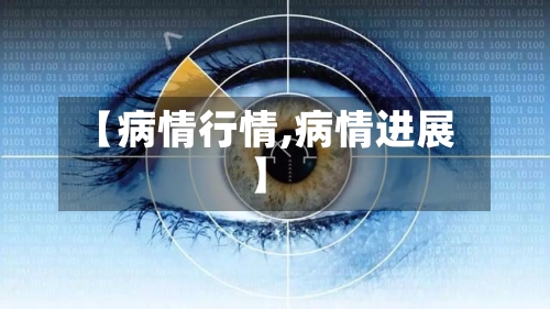 【病情行情,病情进展】-第1张图片